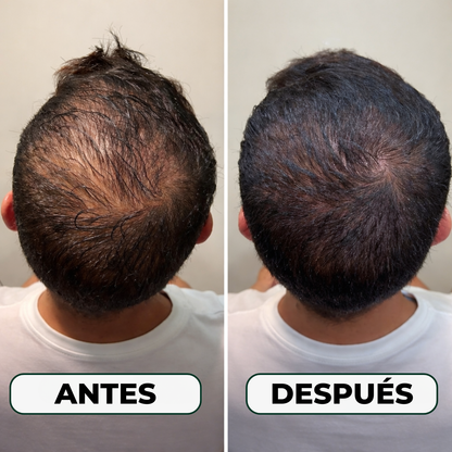 Fórmula Natural Para el Crecimiento del Cabello Triple Acción